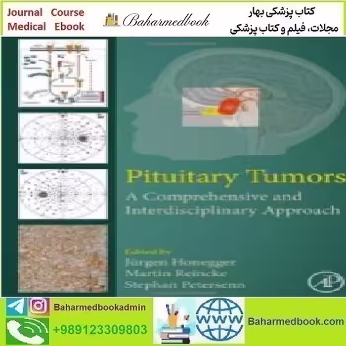 Pituitary Tumors A Comprehensive and Interdisciplinary Approach