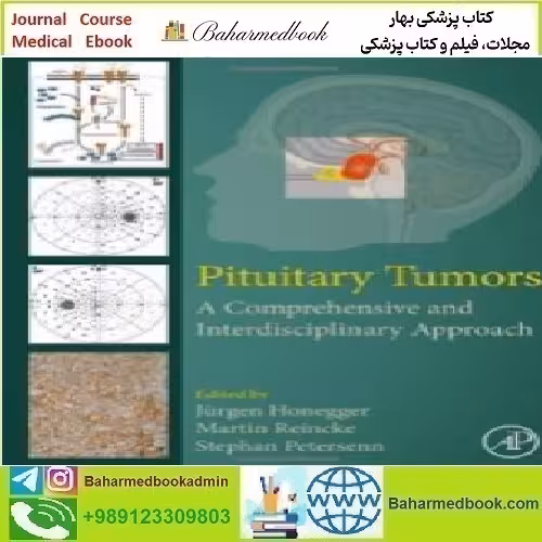 Pituitary Tumors A Comprehensive and Interdisciplinary Approach