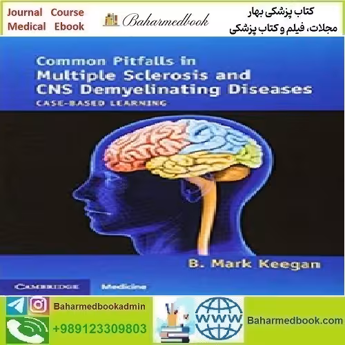Common Pitfalls in Multiple Sclerosis and CNS Demyelinating