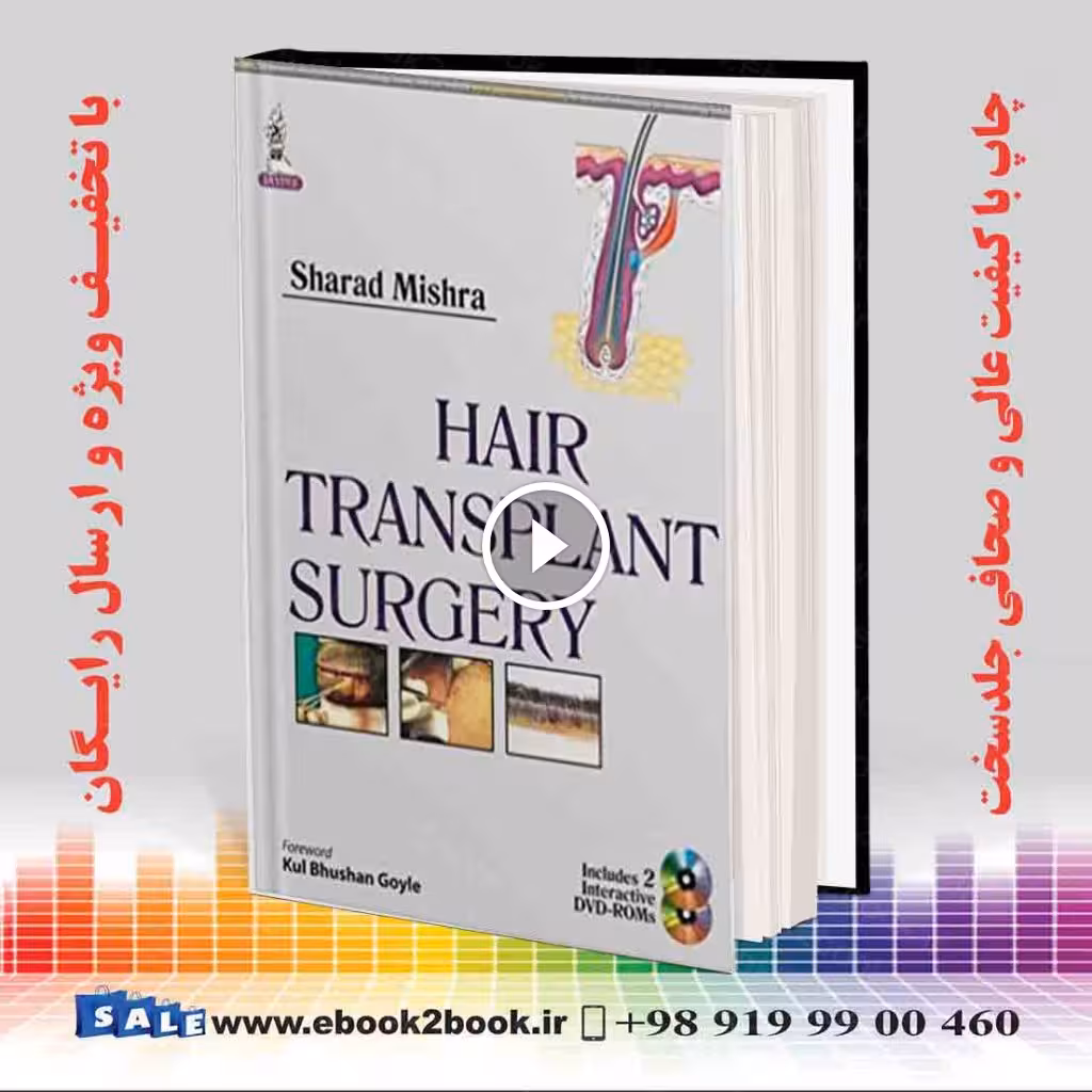 Hair Transplant Surgery