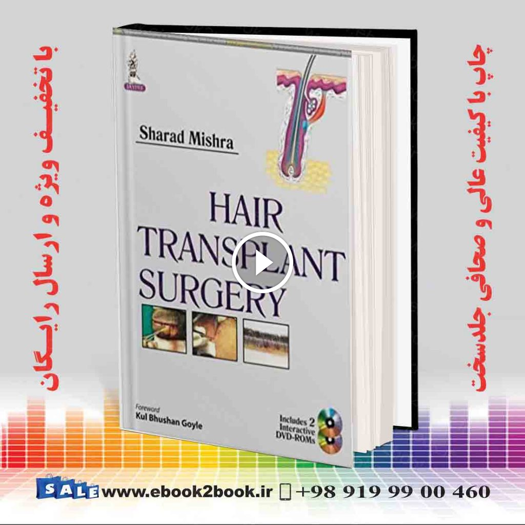 Hair Transplant Surgery