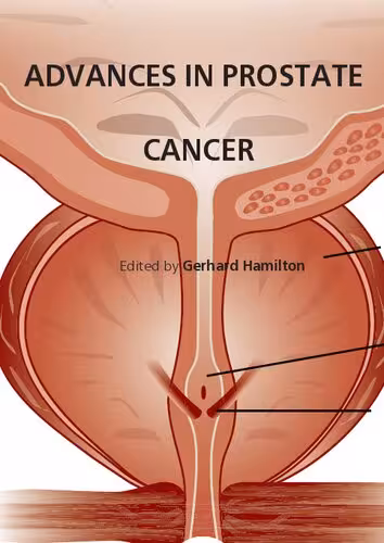 󾕇 دانلود کتاب Advances In Prostate Cancer, 2013 - دانلود کتاب های دانشگاهی