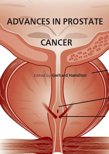  دانلود کتاب Advances In Prostate Cancer, 2013 - دانلود کتاب های دانشگاهی