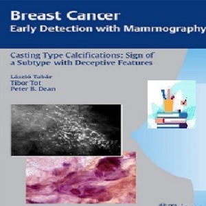 Breast Cancer Early Detection with Mammography TRUE PDF pr