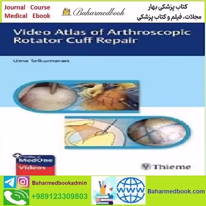 Video Atlas of Arthroscopic Rotator Cuff Repair TRUE PDF price 1€ - کتاب پزشکی بهار