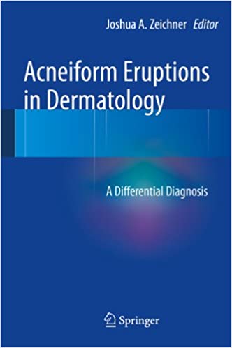  دانلود کتاب Acneiform Eruptions In Dermatology - A Differential Diagnosis, 2013 - دانلود کتاب های دانشگاهی