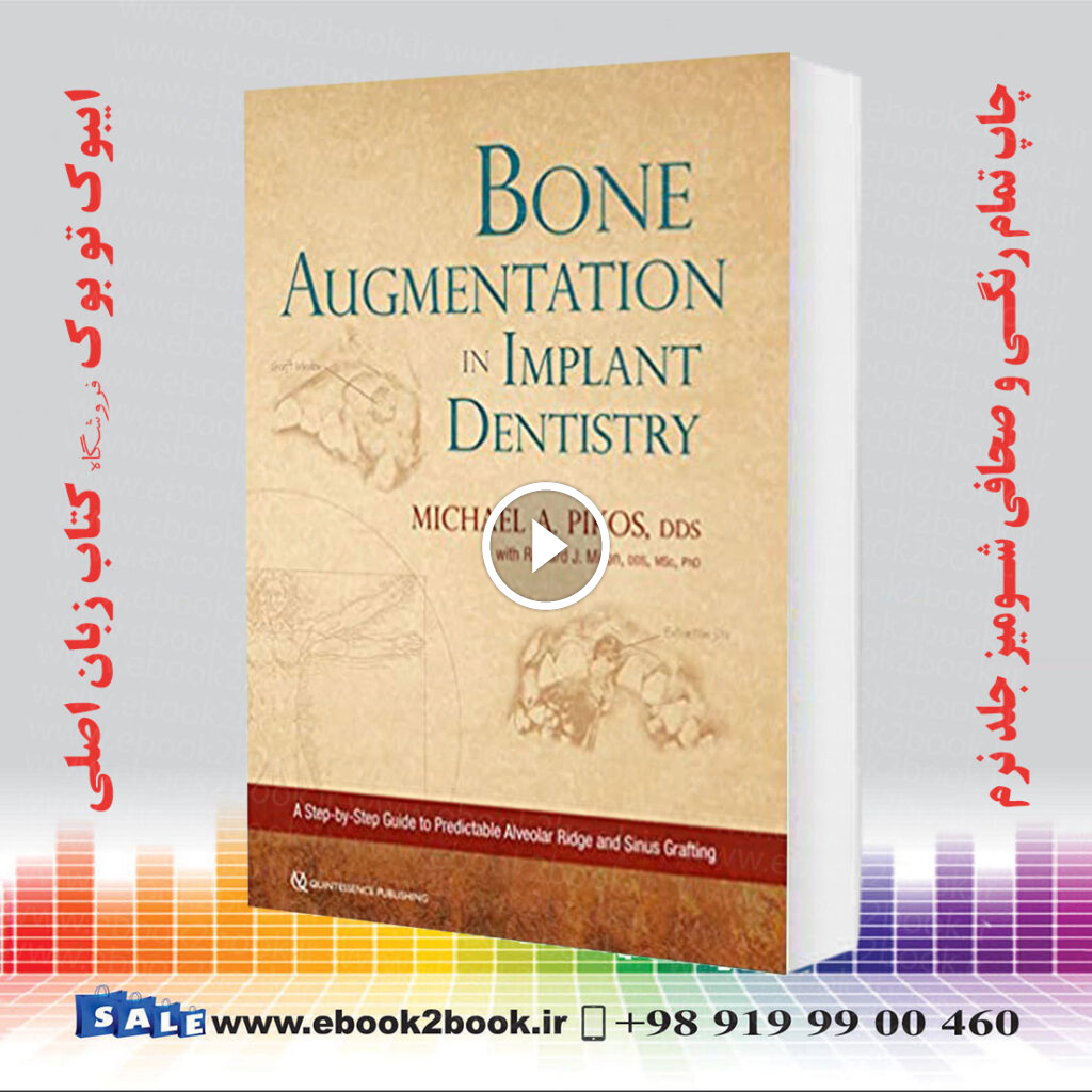 Bone Augmentation in Implant Dentistry