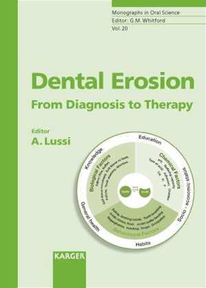 [PDF] دانلود کتاب Dental Erosion From Diagnosis To Therapy, 2006