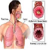 آسم, خوراکی ها, ورزش های مفید و مضر برای آسم