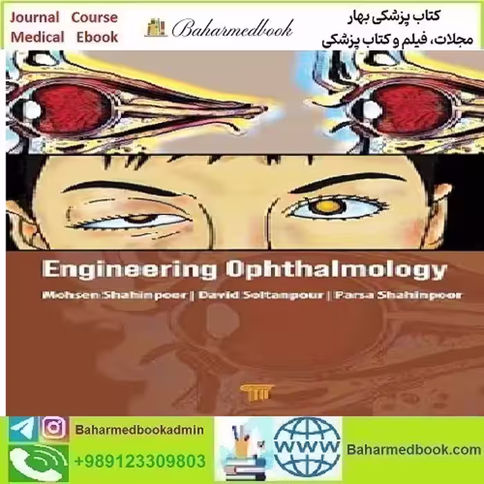 Engineering Ophthalmology 2024 TRUE PDF price 5€ - کتاب پزشکی بهار