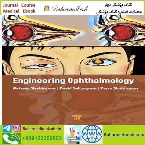 Engineering Ophthalmology 2024 TRUE PDF price 5€ - کتاب پزشکی بهار