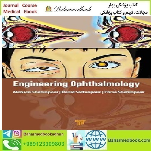 Engineering Ophthalmology 2024 TRUE PDF price 5€ - کتاب پزشکی بهار