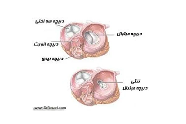 اطلاعات کامل و جامع درباره بیماریهای دریچههای قلبی بیماریها, بیماری دریچه قلبی, دریچه قلب - کتابخانه مجازی واتیکان