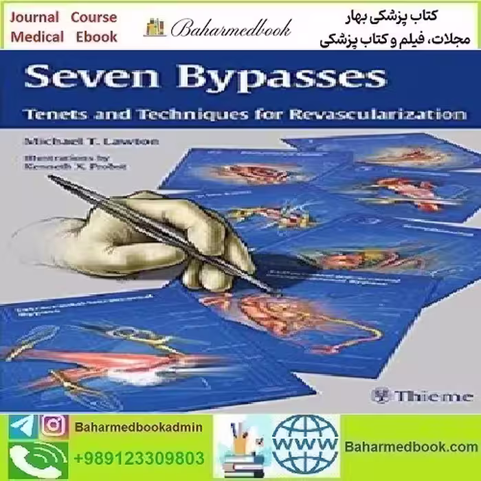 Seven Bypasses Tenets and Techniques for Revascularization