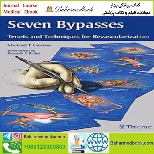 Seven Bypasses Tenets and Techniques for Revascularization