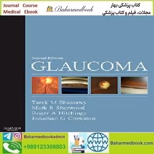 Glaucoma 2Volume Set  Video 2015 TRUE PDF price 2€ - کتاب پزشکی بهار