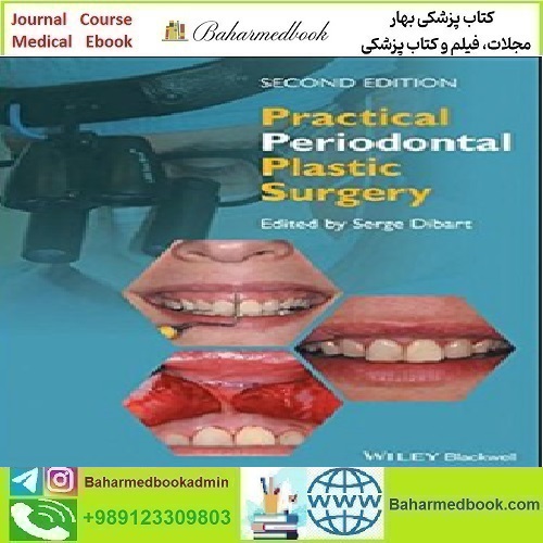 Practical Periodontal Plastic Surgery 2017 TRUE PDF price 1€ - کتاب پزشکی بهار
