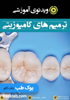 ویدئوی آموزشی ترمیم های کامپوزیتی (انگلیسی)