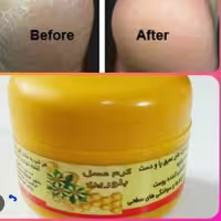 کرم ترک پا بلورین