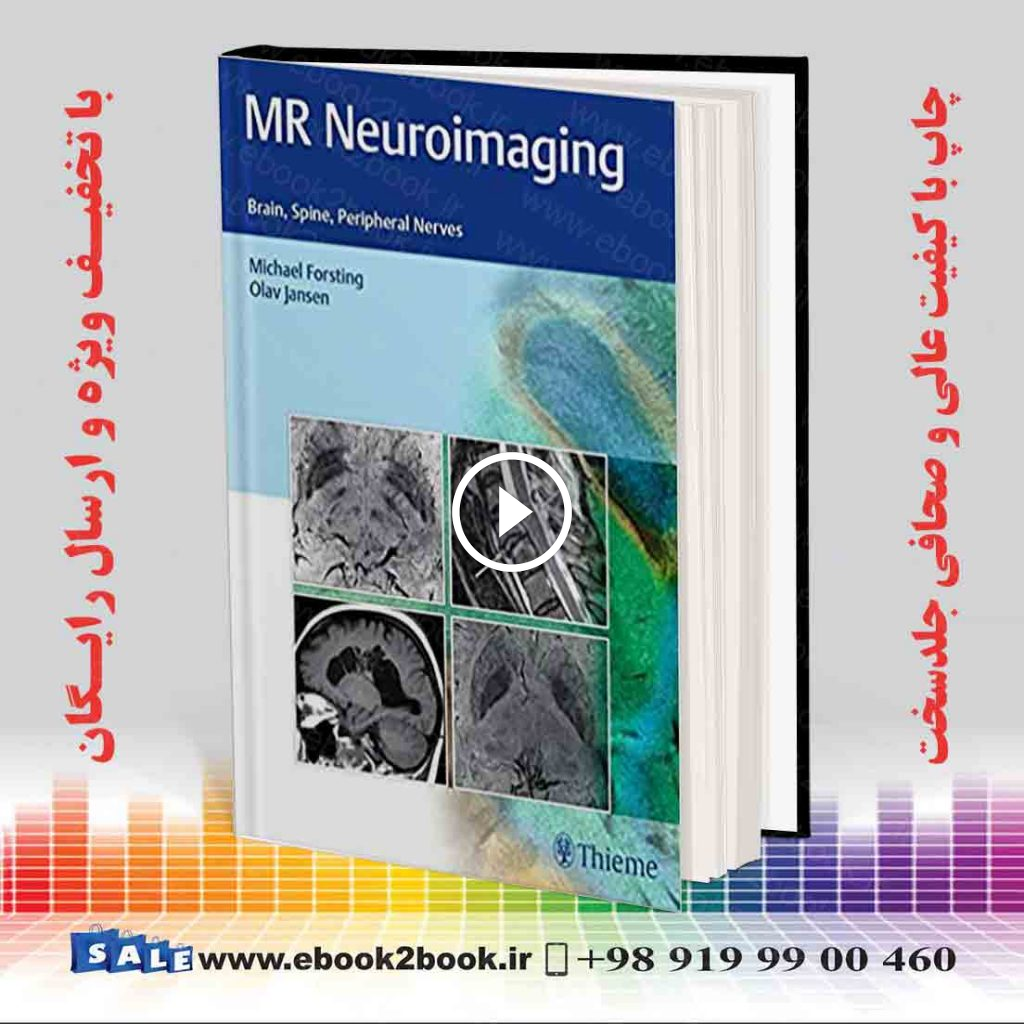 MR Neuroimaging: Brain Spine and Peripheral Nerves