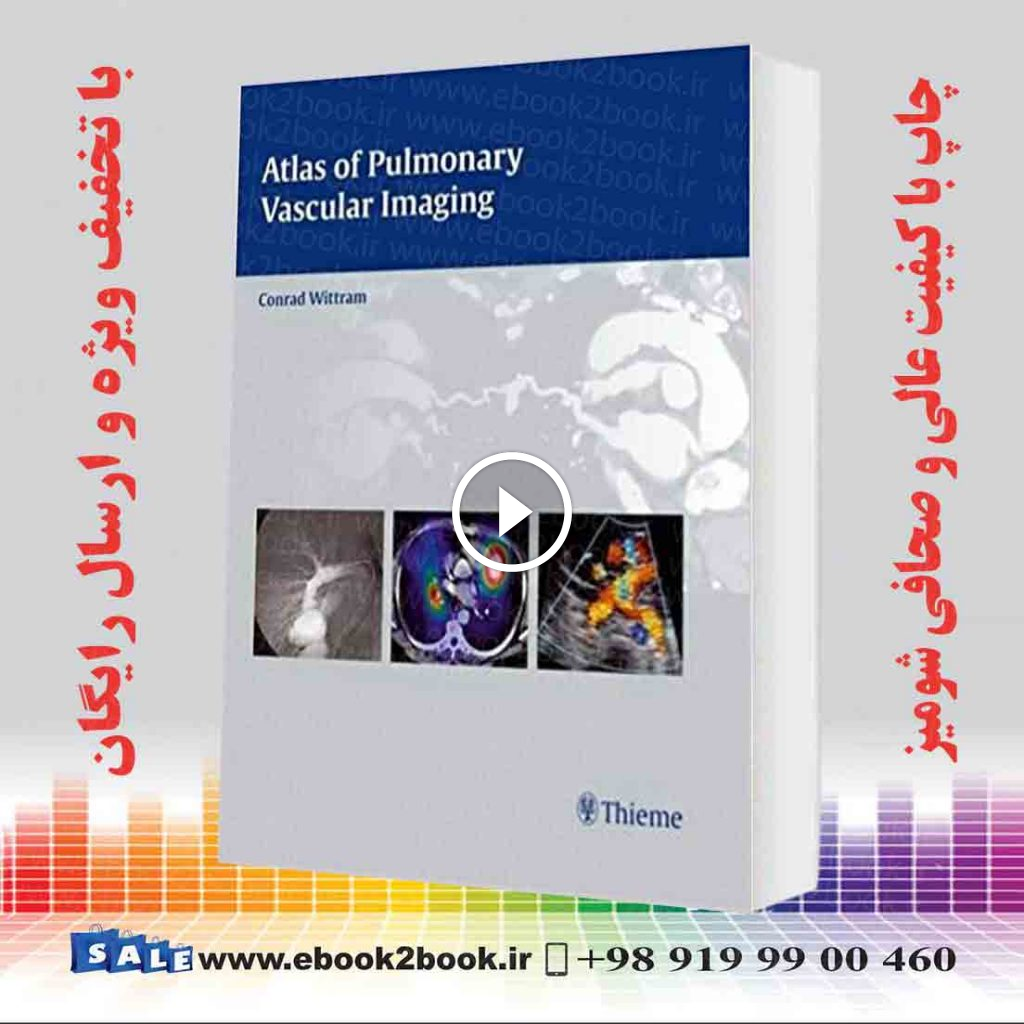 Atlas of Pulmonary Vascular Imaging
