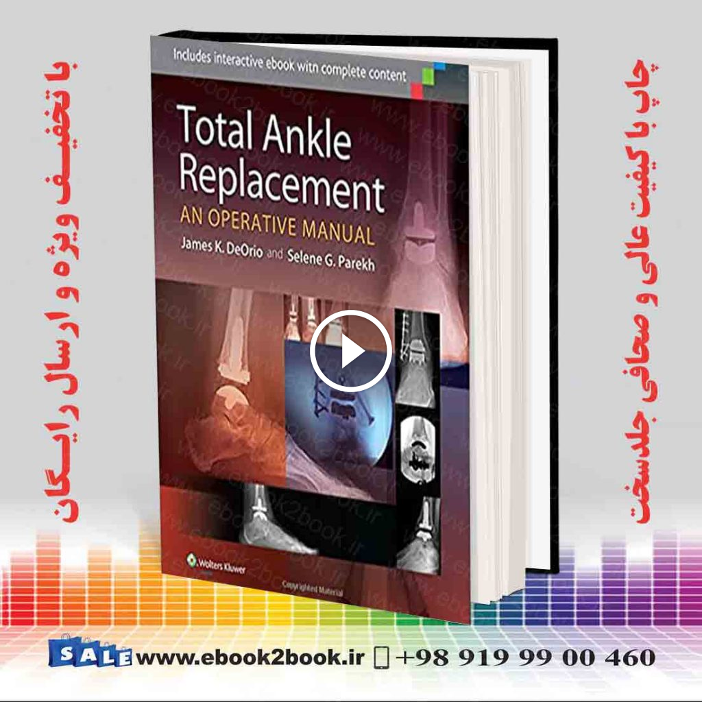 Total Ankle Replacement: An Operative Manual First Edition