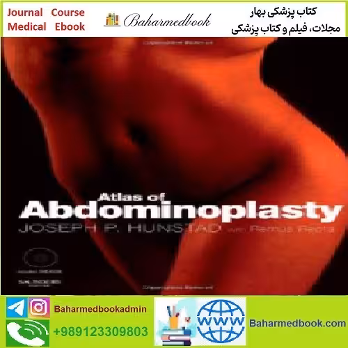 Atlas of Abdominoplasty TRUE PDF price 1€ - کتاب پزشکی بهار