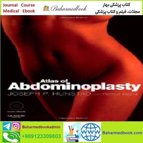 Atlas of Abdominoplasty TRUE PDF price 1€ - کتاب پزشکی بهار