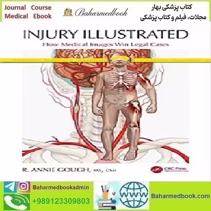 Injury Illustrated How Medical Images Win Legal Cases 2021