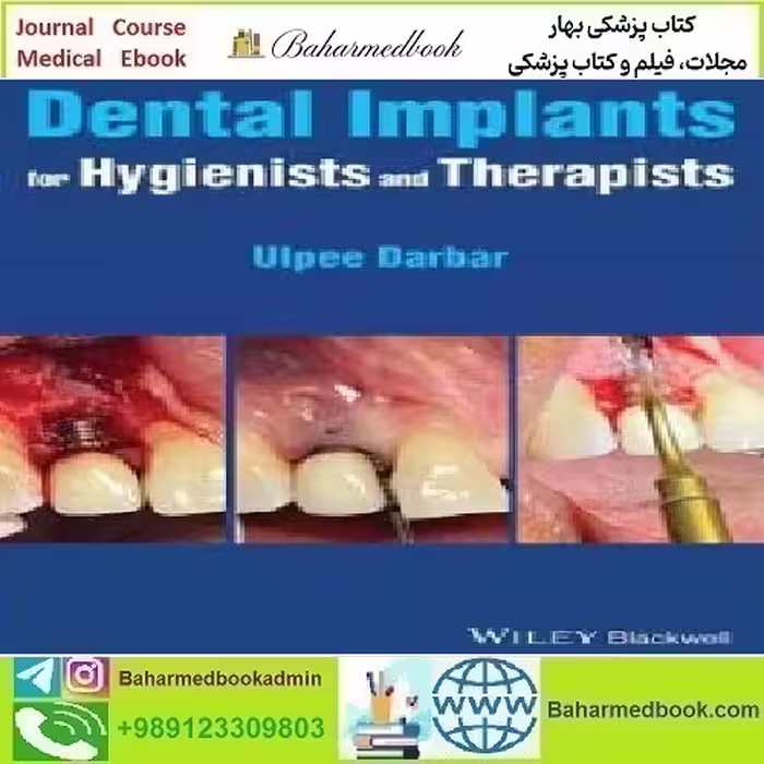 Dental Implants for Hygienists and Therapists 2022 TRU
