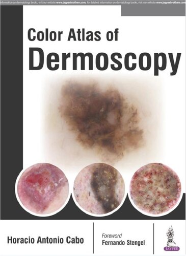 خرید و دانلود نسخه کامل کتاب Colour Atlas of Dermoscopy