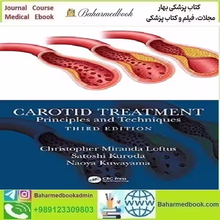 Carotid Treatment Principles and
