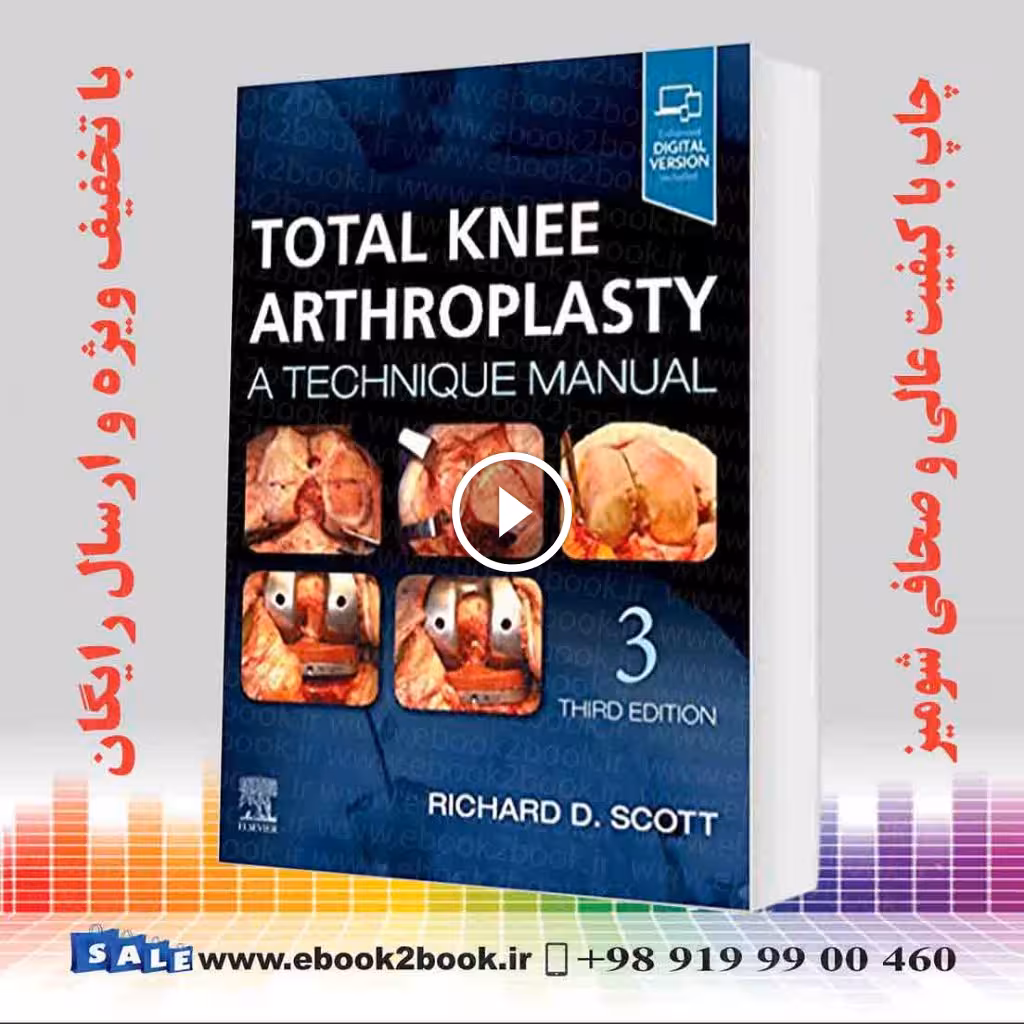 Total Knee Arthroplasty 3rd Edition
