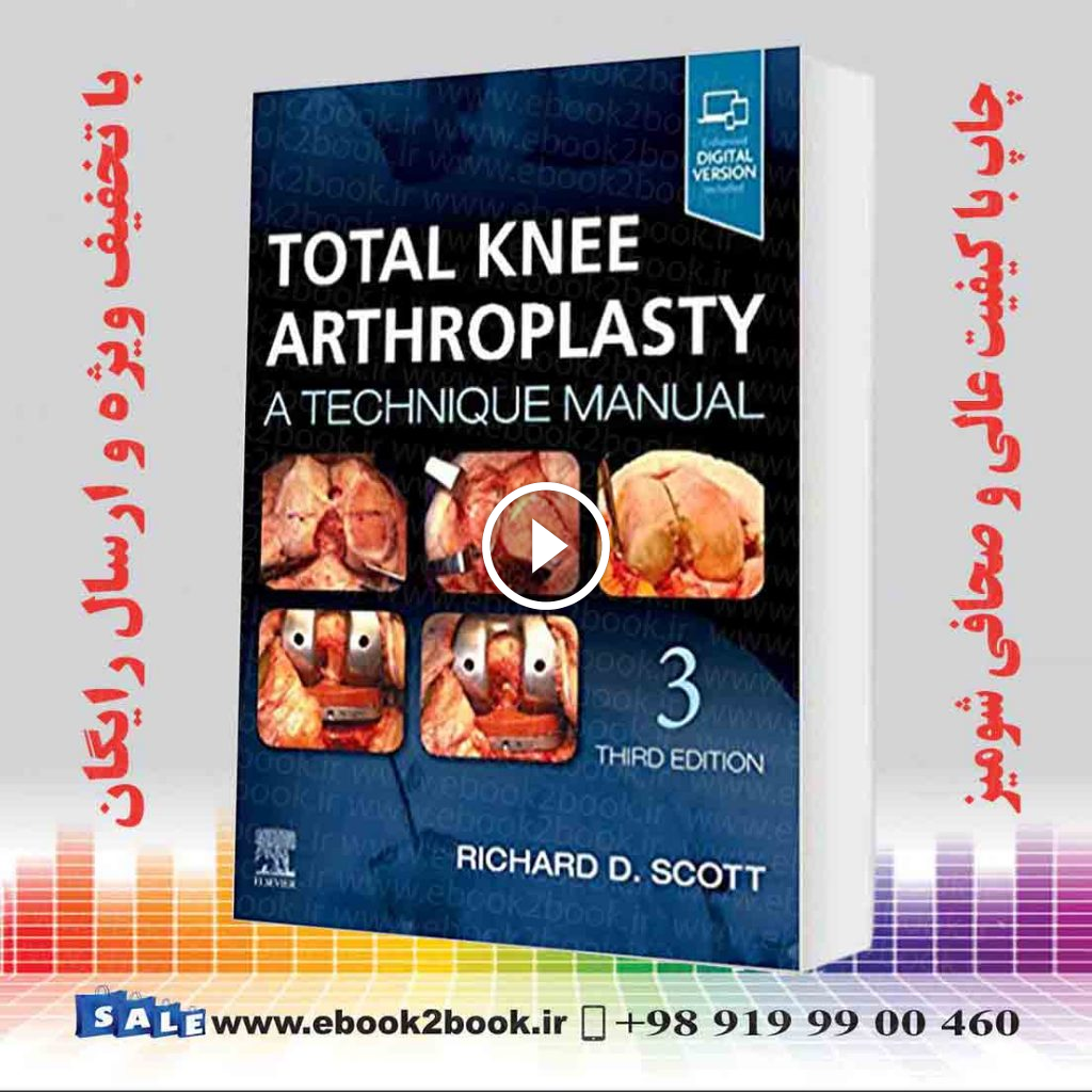 Total Knee Arthroplasty 3rd Edition