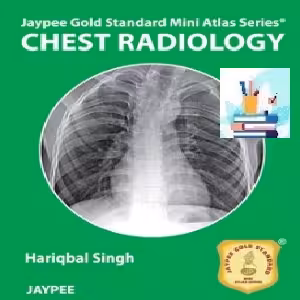 Chest Radiology TRUE PDF price 1€