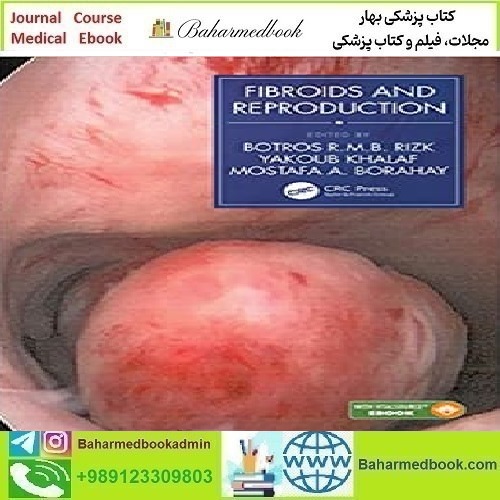 Fibroids and Reproduction 2021 TRUE PDF price 1€ - کتاب پزشکی بهار