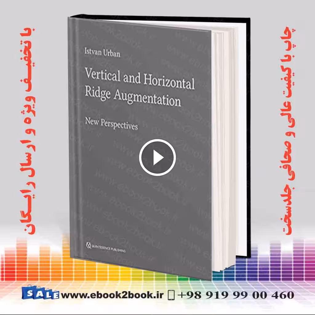 Vertical and Horizontal Ridge Augmentation