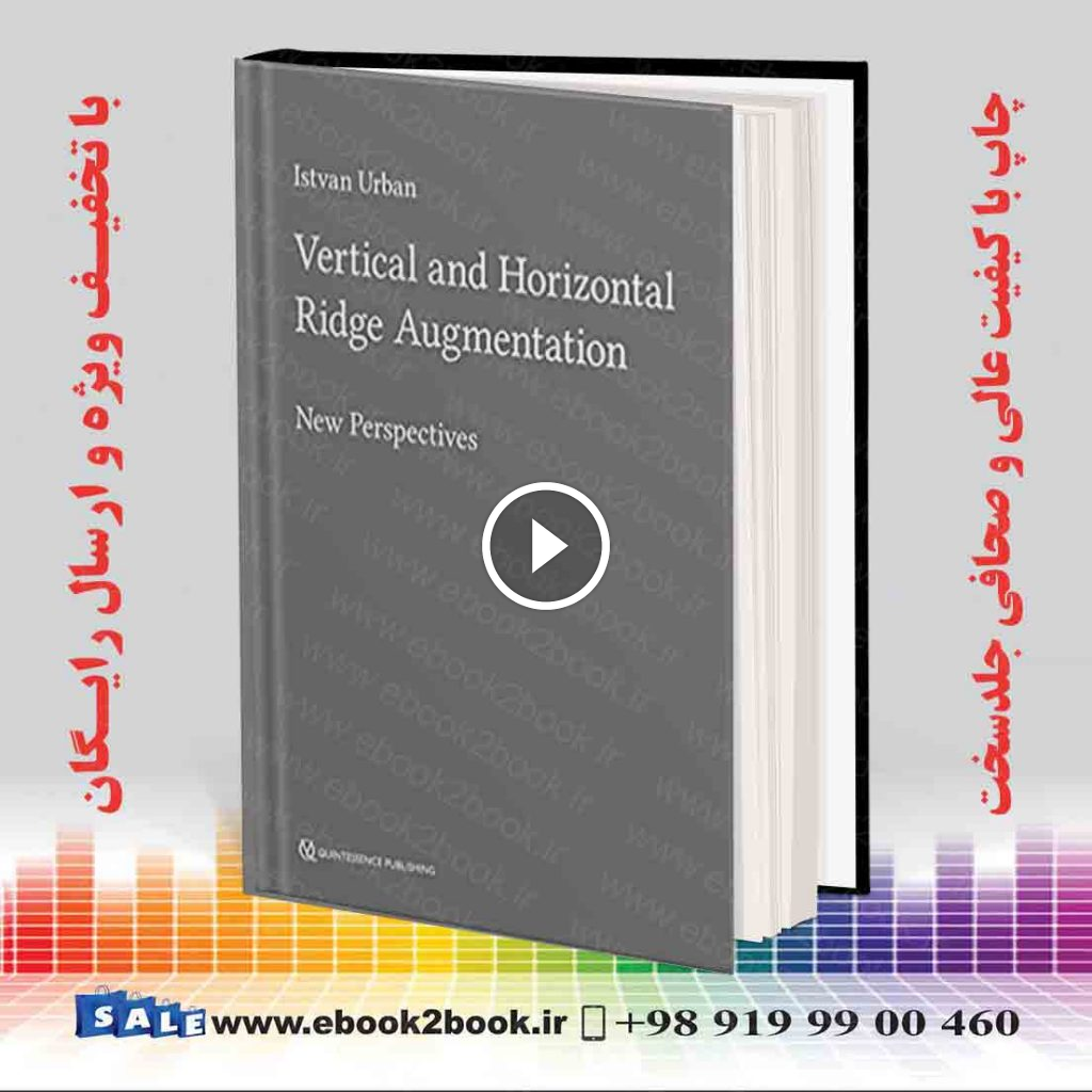 Vertical and Horizontal Ridge Augmentation