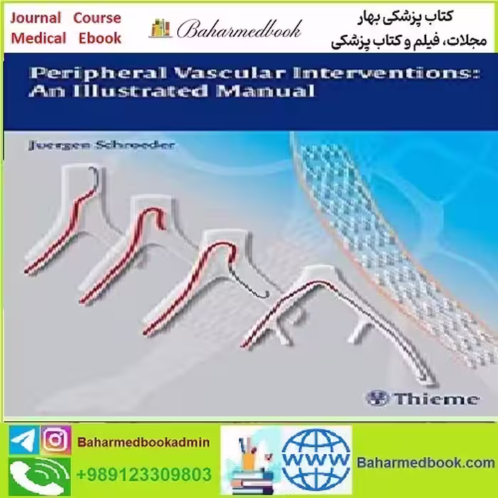 Peripheral Vascular Interventions An Illustrated Manual TRUE P