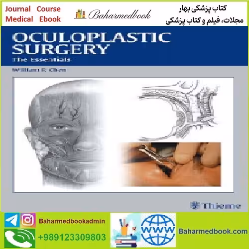 Oculoplastic Surgery TRUE PDF price 1€ - کتاب پزشکی بهار