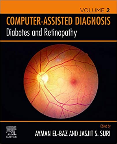  دانلود کتاب Diabetes And Retinopathy, 2020 - دانلود کتاب های دانشگاهی