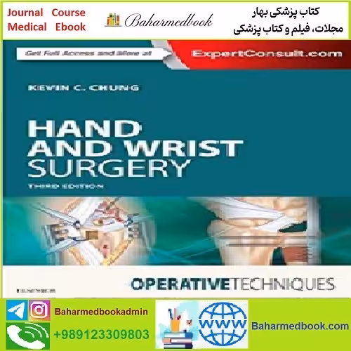 Hand and Wrist Surgery TRUE PDF price 1€