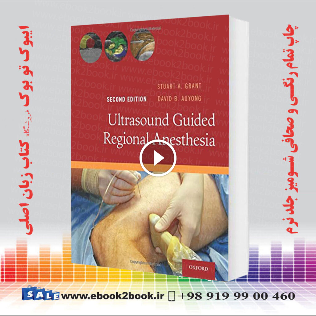 Ultrasound Guided Regional Anesthesia 2nd Edition