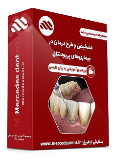 ویدئوی تشخیص و طرح درمان در بیماری های پریودنتال