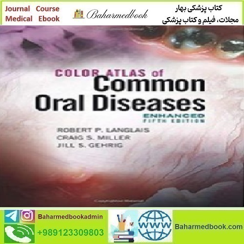 Color Atlas of Common Oral Diseases Enhanced Edition 2021 T