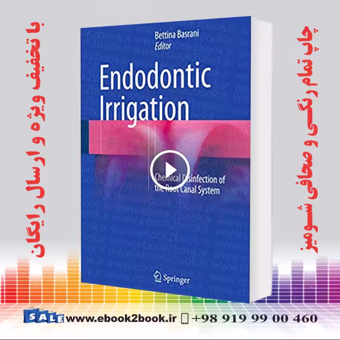 Endodontic Irrigation : Chemical disinfection of the root canal system