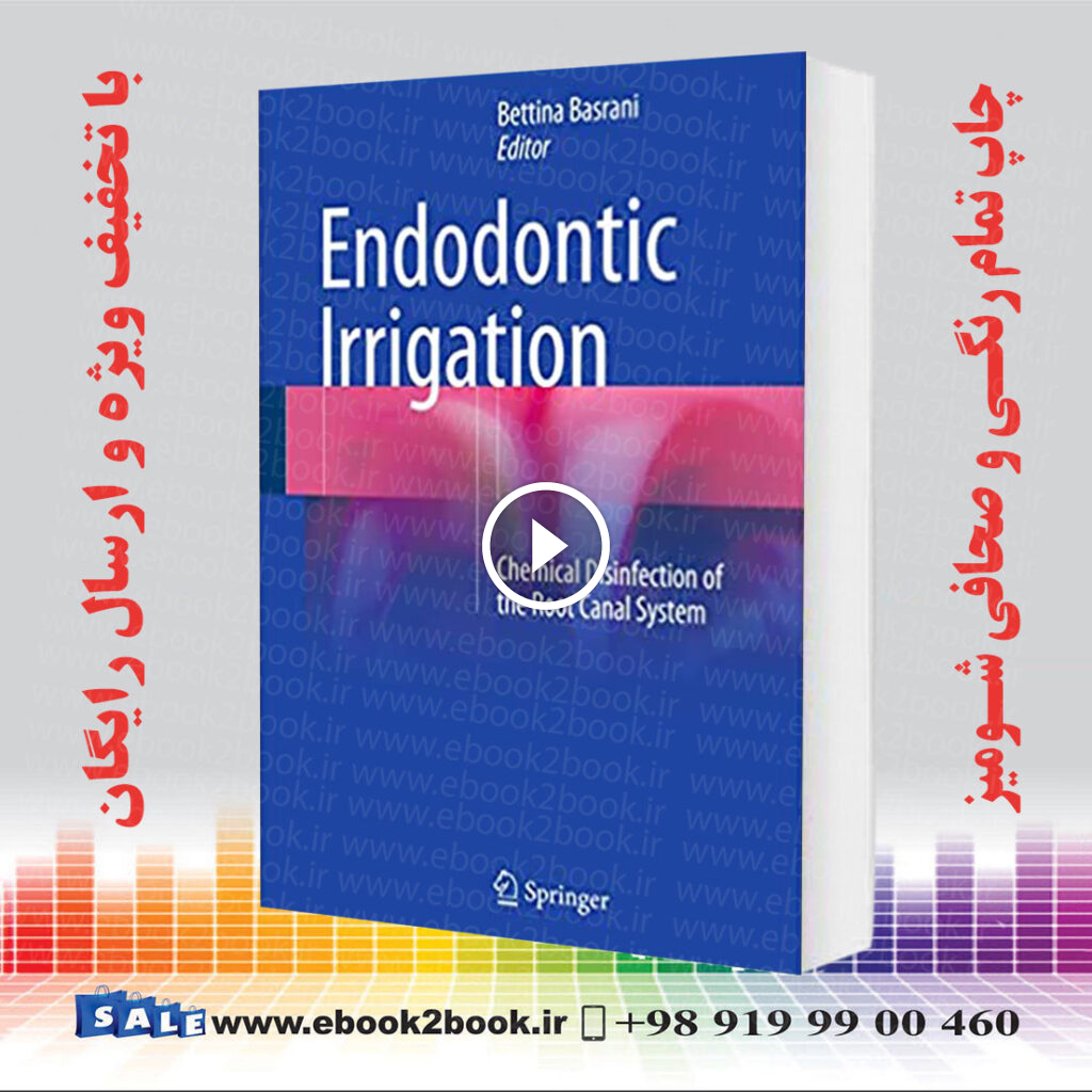 Endodontic Irrigation : Chemical disinfection of the root canal system