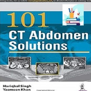 101Ct Abdomen Solutions TRUE PDF price 1€