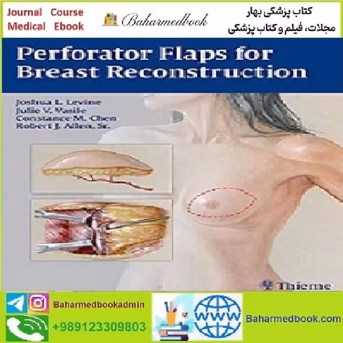 Perforator Flaps for Breast Reconstruction TRUE PDF price 1€ - کتاب پزشکی بهار