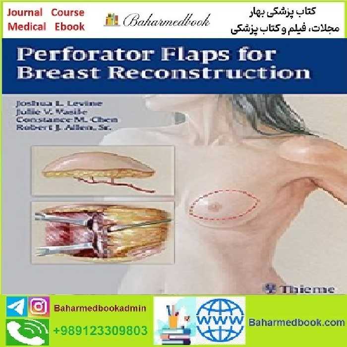 Perforator Flaps for Breast Reconstruction TRUE PDF price 1€ - کتاب پزشکی بهار